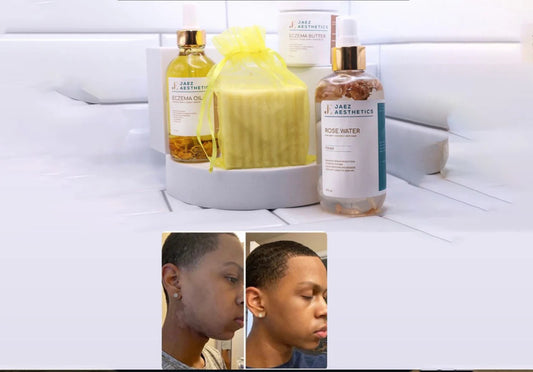 Dry Skin Kit