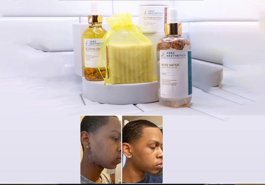 Dry Skin Kit